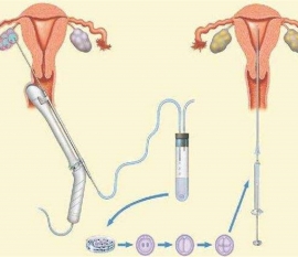 35岁女性备孕请做好以下检查，“健康太原代生宝宝”跑不远